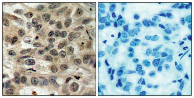 Anti-CDC25C antibody produced in rabbit affinity isolated antibody