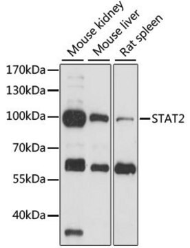 Anti-STAT2 antibody produced in rabbit