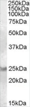 Anti-RAB8A antibody produced in goat affinity isolated antibody, buffered aqueous solution