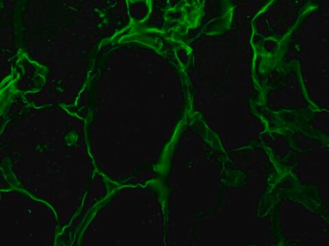 Anti-Vimentin antibody produced in goat whole antiserum