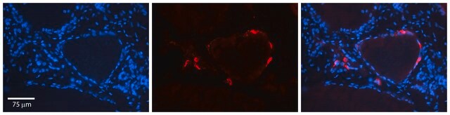 Anti-IL6ST antibody produced in rabbit affinity isolated antibody