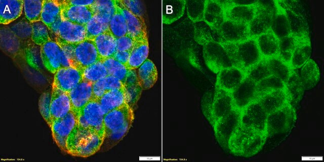 Anti-SLC31A1/CTR1 Antibody, clone 1K21 ZooMAb&#174; Rabbit Monoclonal recombinant, expressed in HEK 293 cells