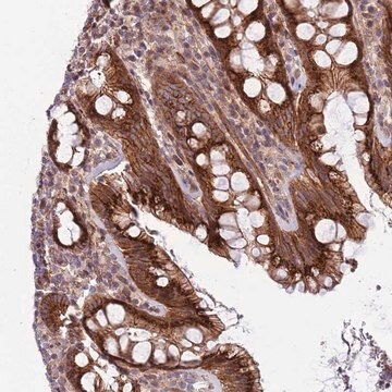 Anti-ITGB6 antibody produced in rabbit Prestige Antibodies&#174; Powered by Atlas Antibodies, affinity isolated antibody, buffered aqueous glycerol solution