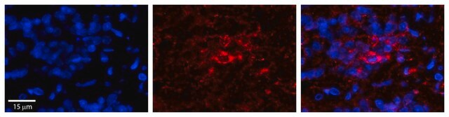 Anti-SGK1 antibody produced in rabbit affinity isolated antibody