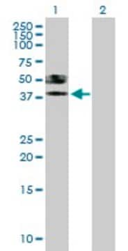 Anti-ST6GALNAC6 antibody produced in mouse purified immunoglobulin, buffered aqueous solution