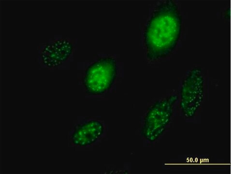 Anti-SCML1 antibody produced in mouse purified immunoglobulin, buffered aqueous solution