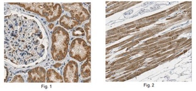 Anti-Complex I-75kD Antibody from rabbit, purified by affinity chromatography