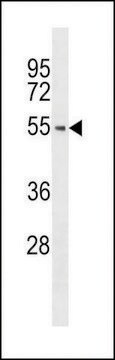 ANTI-BRK (PTK6)(N-TERMINAL) antibody produced in rabbit IgG fraction of antiserum, buffered aqueous solution