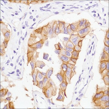 Anti-EGFR antibody, Rabbit monoclonal clone SP125, recombinant, expressed in proprietary host, affinity isolated antibody