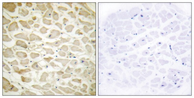 Anti-Collagen XIV &#945;1, N-Terminal antibody produced in rabbit affinity isolated antibody