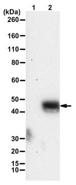 Anti-phospho ULK1(Ser746)