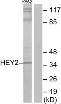 Anti-HEY2 antibody produced in rabbit affinity isolated antibody