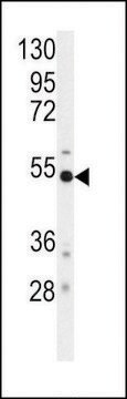 ANTI-BACE (S498) antibody produced in rabbit purified immunoglobulin, buffered aqueous solution