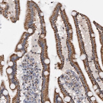 Anti-WFDC1 antibody produced in rabbit Prestige Antibodies&#174; Powered by Atlas Antibodies, affinity isolated antibody, buffered aqueous glycerol solution