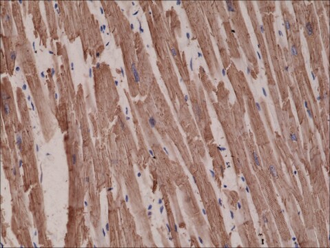 Anti-alpha-Cardiac Actin (ACTC1) antibody, Rabbit monoclonal recombinant, expressed in HEK 293 cells, clone RM257, purified immunoglobulin