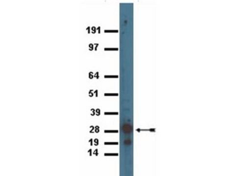 Anticorps anti-GFP Chemicon&#174;, from rabbit