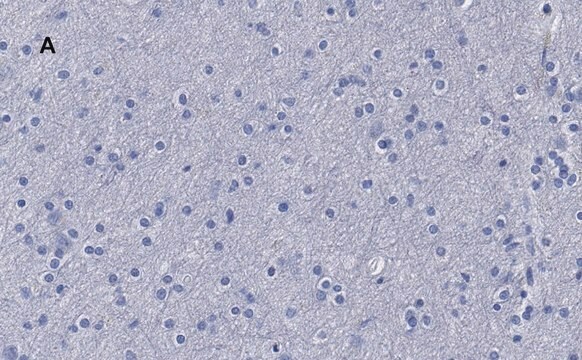 抗&#946;-チューブリンIII抗体 クローン5H16 ZooMAb&#174; ウサギ・モノクローナル recombinant, expressed in HEK 293 cells