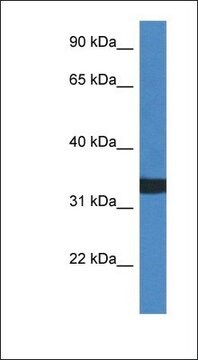 Anti-ACER1 antibody produced in rabbit affinity isolated antibody