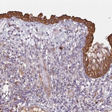 Anti-CEP78 antibody produced in rabbit Prestige Antibodies&#174; Powered by Atlas Antibodies, affinity isolated antibody, buffered aqueous glycerol solution