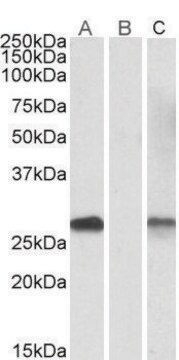 Anti-DYDC1 antibody produced in goat affinity isolated antibody, buffered aqueous solution