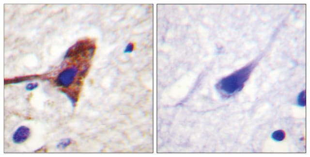 抗-MTOR 兔抗 affinity isolated antibody