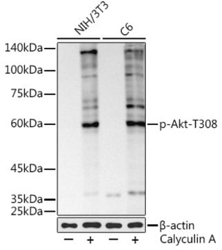 Anti-Phospho-Akt(pThr308) Antibody, clone 5E9G5, Rabbit Monoclonal