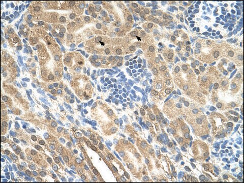 抗 IHH 兔抗 IgG fraction of antiserum