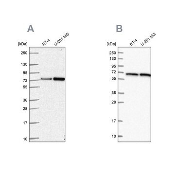 Anti-DLAT Prestige Antibodies&#174; Powered by Atlas Antibodies, affinity isolated antibody