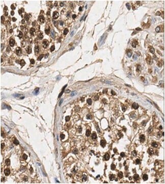 Anticorpo anti-FOXM1 from rabbit, purified by affinity chromatography