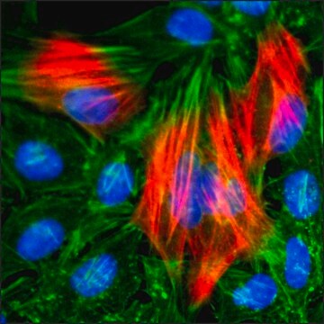 Anti-Calponin-1 antibody, Rabbit monoclonal recombinant, expressed in HEK 293 cells, clone RM262, purified immunoglobulin