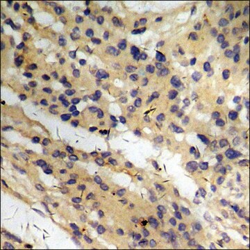 Anti-phospho-CD136/RON (pSer1394) antibody produced in rabbit affinity isolated antibody