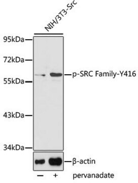 Przeciwciało anty-Phospho-SRCFamily-Y416 produkowane u królików