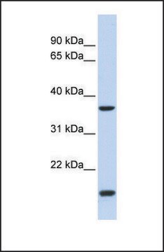 Anti-ZIC4, (N-terminal) antibody produced in rabbit affinity isolated antibody