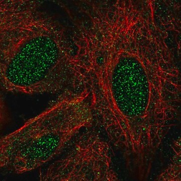 抗LHX8抗体 ウサギ宿主抗体 Prestige Antibodies&#174; Powered by Atlas Antibodies, affinity isolated antibody