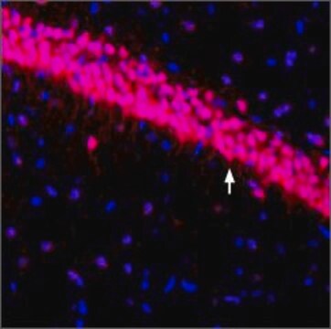 Anti-Potassium Channel Kv4.3 antibody produced in rabbit affinity isolated antibody, lyophilized powder