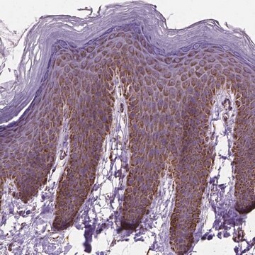 Anti-RMDN3 antibody produced in rabbit Prestige Antibodies&#174; Powered by Atlas Antibodies, affinity isolated antibody, buffered aqueous glycerol solution