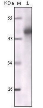 Monoclonal Anti-Cytokeratin (Pan) antibody produced in mouse clone 7H8C4, ascites fluid