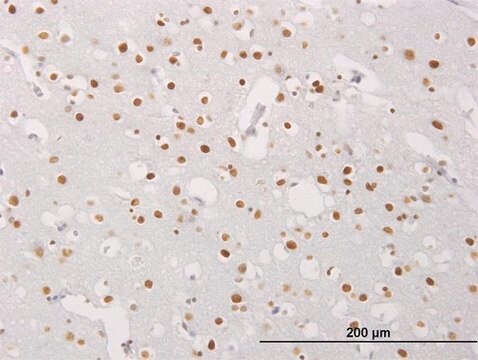 Monoclonal Anti-MECP2 antibody produced in mouse clone 1B11, purified immunoglobulin, buffered aqueous solution