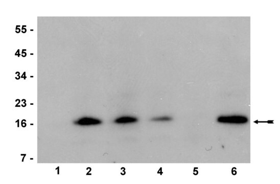 Anti-trimethyl-Histone H3 (Lys36) Antibody, clone MC86, rabbit monoclonal clone MC86, Upstate&#174;, from rabbit