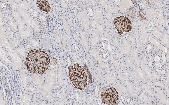 抗ネスチン抗体 クローン10C2 ZooMAb&#174;マウス・モノクローナル recombinant, expressed in HEK 293 cells