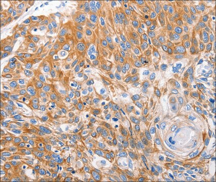 Anti-LRP2 antibody produced in rabbit affinity isolated antibody