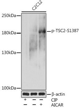 Anti-Phospho-TSC2-S1387 antibody produced in rabbit