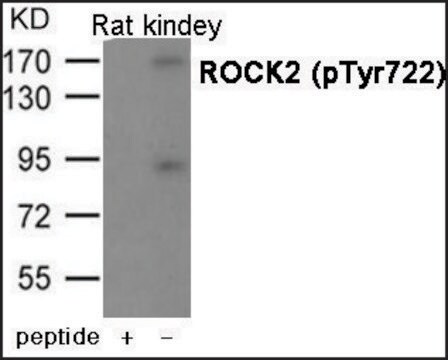 Anty-fosfoROCK2(pTyr722) affinity isolated antibody