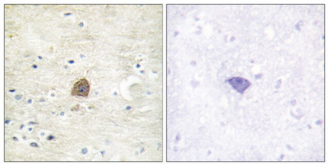 Anty-fosfo-CaMK2α/β/δ(pThr305) affinity isolated antibody