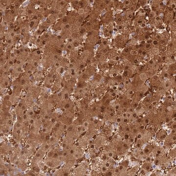 Anti-PGM1 antibody produced in rabbit Prestige Antibodies&#174; Powered by Atlas Antibodies, affinity isolated antibody, buffered aqueous glycerol solution