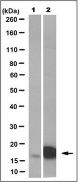 Anti-SOD1 Antibody (ALS mutant), clone MS785 clone MS785, from rat