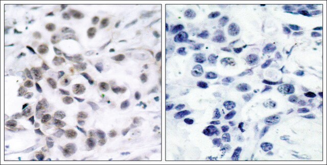 Anti-CHEK1 (Ab-317) antibody produced in rabbit affinity isolated antibody