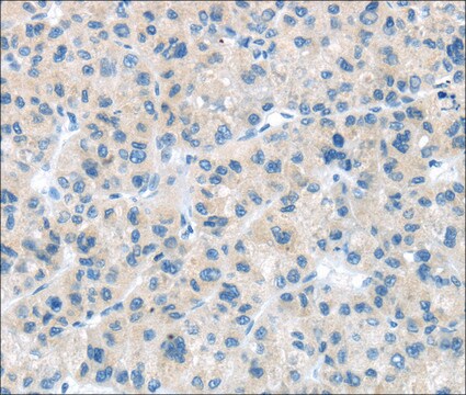 抗 CD63 affinity isolated antibody