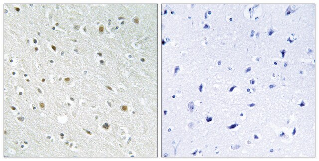 Anti-SSBP2 antibody produced in rabbit affinity isolated antibody