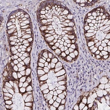 Anti-ZNF813 antibody produced in rabbit Prestige Antibodies&#174; Powered by Atlas Antibodies, affinity isolated antibody, buffered aqueous glycerol solution